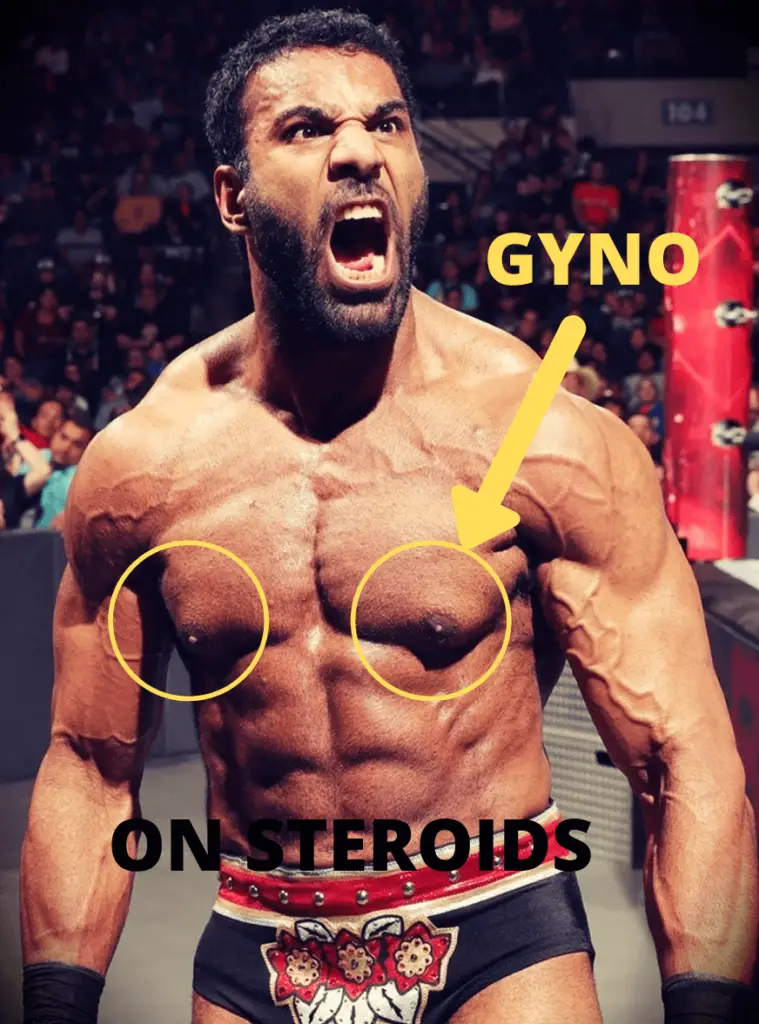 Jinder Mahal using steroids, gyno